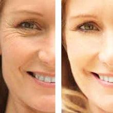 Load image into Gallery viewer, Age Defense : Eye Wrinkle Cream + Vitamin C Serum